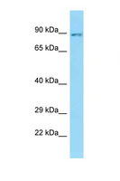 SLC26A6 / PAT1 Antibody - SLC26A6 antibody Western blot of PANC1 Cell lysate. Antibody concentration 1 ug/ml.  This image was taken for the unconjugated form of this product. Other forms have not been tested.