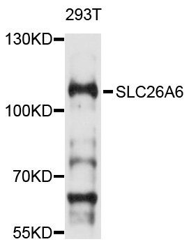 SLC26A6 / PAT1 Antibody - Western blot analysis of extracts of 293T cells, using SLC26A6 antibody at 1:1000 dilution. The secondary antibody used was an HRP Goat Anti-Rabbit IgG (H+L) at 1:10000 dilution. Lysates were loaded 25ug per lane and 3% nonfat dry milk in TBST was used for blocking. An ECL Kit was used for detection and the exposure time was 90s.