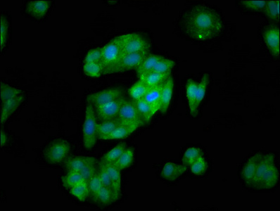 SLC26A6 / PAT1 Antibody - Immunofluorescence staining of HepG2 cells at a dilution of 1:133, counter-stained with DAPI. The cells were fixed in 4% formaldehyde, permeabilized using 0.2% Triton X-100 and blocked in 10% normal Goat Serum. The cells were then incubated with the antibody overnight at 4 °C.The secondary antibody was Alexa Fluor 488-congugated AffiniPure Goat Anti-Rabbit IgG (H+L) .