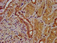 SLC26A6 / PAT1 Antibody - Immunohistochemistry image at a dilution of 1:400 and staining in paraffin-embedded human kidney tissue performed on a Leica BondTM system. After dewaxing and hydration, antigen retrieval was mediated by high pressure in a citrate buffer (pH 6.0) . Section was blocked with 10% normal goat serum 30min at RT. Then primary antibody (1% BSA) was incubated at 4 °C overnight. The primary is detected by a biotinylated secondary antibody and visualized using an HRP conjugated SP system.