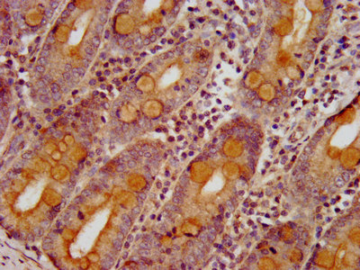SLC26A6 / PAT1 Antibody - Immunohistochemistry image at a dilution of 1:400 and staining in paraffin-embedded human small intestine tissue performed on a Leica BondTM system. After dewaxing and hydration, antigen retrieval was mediated by high pressure in a citrate buffer (pH 6.0) . Section was blocked with 10% normal goat serum 30min at RT. Then primary antibody (1% BSA) was incubated at 4 °C overnight. The primary is detected by a biotinylated secondary antibody and visualized using an HRP conjugated SP system.