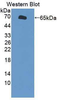 SLC26A8 / TAT1 Antibody - Western blot of SLC26A8 / TAT1 antibody.