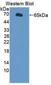 SLC26A8 / TAT1 Antibody - Western blot of SLC26A8 / TAT1 antibody.