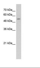 SLC26A8 / TAT1 Antibody - Jurkat Cell Lysate.  This image was taken for the unconjugated form of this product. Other forms have not been tested.