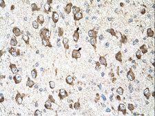 SLC26A8 / TAT1 Antibody - SLC26A8 / Tat 1 antibody ARP44085_T100-CAI40882-SLC26A8(solute carrier family 26, member 8) Antibody was used in IHC to stain formalin-fixed, paraffin-embedded human brain.  This image was taken for the unconjugated form of this product. Other forms have not been tested.