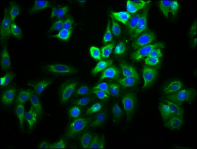 SLC26A9 Antibody - Immunofluorescence staining of HepG2 cells diluted at 1:66, counter-stained with DAPI. The cells were fixed in 4% formaldehyde, permeabilized using 0.2% Triton X-100 and blocked in 10% normal Goat Serum. The cells were then incubated with the antibody overnight at 4°C.The Secondary antibody was Alexa Fluor 488-congugated AffiniPure Goat Anti-Rabbit IgG (H+L).