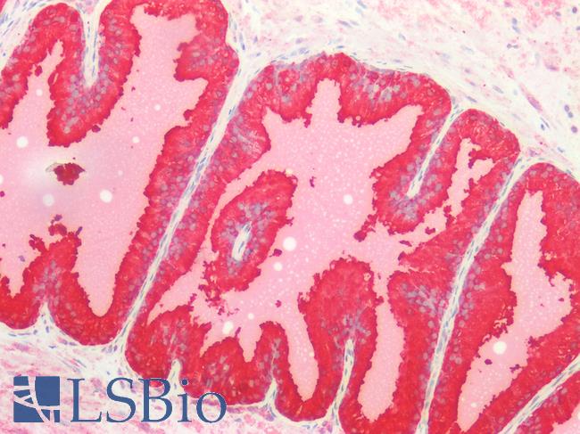 SLC27A1 / FATP Antibody - Human Prostate: Formalin-Fixed, Paraffin-Embedded (FFPE)