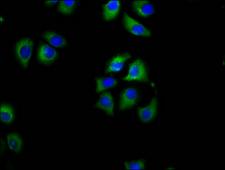 SLC27A1 / FATP Antibody - Immunofluorescence staining of A549 cells diluted at 1:100, counter-stained with DAPI. The cells were fixed in 4% formaldehyde, permeabilized using 0.2% Triton X-100 and blocked in 10% normal Goat Serum. The cells were then incubated with the antibody overnight at 4°C.The Secondary antibody was Alexa Fluor 488-congugated AffiniPure Goat Anti-Rabbit IgG (H+L).