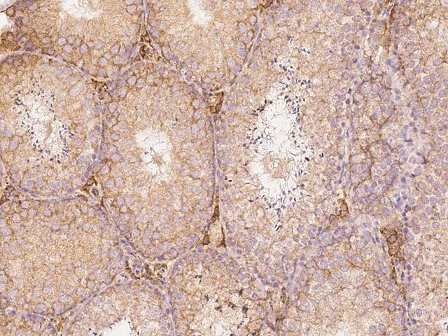 SLC27A3 Antibody - Immunochemical staining of mouse SLC27A3 in mouse testis with rabbit polyclonal antibody at 1:1000 dilution, formalin-fixed paraffin embedded sections.