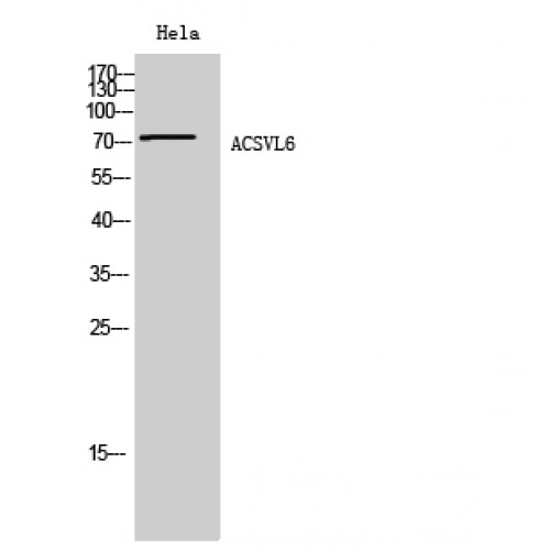 SLC27A5 / BACS Antibody - Western blot of ACSVL6 antibody