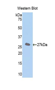 SLC27A5 / BACS Antibody - Western blot of SLC27A5 / BACS antibody.