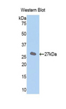 SLC27A5 / BACS Antibody - Western blot of SLC27A5 / BACS antibody.