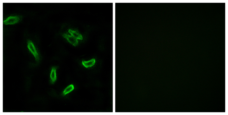 SLC27A5 / BACS Antibody - Immunofluorescence analysis of A549 cells, using SLC27A5 Antibody. The picture on the right is blocked with the synthesized peptide.