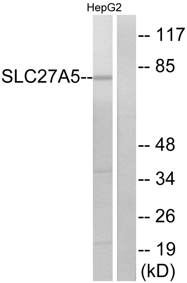 SLC27A5 / BACS Antibody - Western blot analysis of lysates from HepG2 cells, using SLC27A5 Antibody. The lane on the right is blocked with the synthesized peptide.