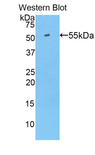 SLC27A5 / BACS Antibody - Western blot of recombinant SLC27A5 / BACS.  This image was taken for the unconjugated form of this product. Other forms have not been tested.