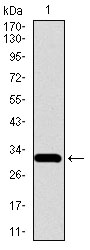 SLC27A5 / BACS Antibody - Western blot using SLC27A5 monoclonal antibody against human SLC27A5 recombinant protein. (Expected MW is 32.9 kDa)