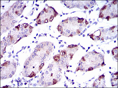 SLC27A5 / BACS Antibody - IHC of paraffin-embedded stomach tissues using SLC27A5 mouse monoclonal antibody with DAB staining.