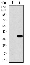 SLC27A5 / BACS Antibody - Western blot using SLC27A5 monoclonal antibody against HEK293 (1) and SLC27A5 (AA: 508-570)-hIgGFc transfected HEK293 (2) cell lysate.