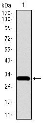 SLC27A5 / BACS Antibody - SLC27A5 Antibody in Western Blot (WB)