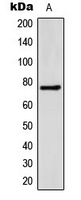 SLC27A5 / BACS Antibody - Western blot analysis of FATP5 expression in HeLa (A) whole cell lysates.