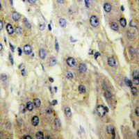 SLC27A5 / BACS Antibody - Immunohistochemical analysis of FATP5 staining in human liver formalin fixed paraffin embedded tissue section. The section was pre-treated using heat mediated antigen retrieval with sodium citrate buffer (pH 6.0). The section was then incubated with the antibody at room temperature and detected using an HRP conjugated compact polymer system. DAB was used as the chromogen. The section was then counterstained with hematoxylin and mounted with DPX.