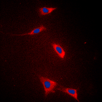 SLC27A5 / BACS Antibody - Immunofluorescent analysis of FATP5 staining in HeLa cells. Formalin-fixed cells were permeabilized with 0.1% Triton X-100 in TBS for 5-10 minutes and blocked with 3% BSA-PBS for 30 minutes at room temperature. Cells were probed with the primary antibody in 3% BSA-PBS and incubated overnight at 4 C in a humidified chamber. Cells were washed with PBST and incubated with a DyLight 594-conjugated secondary antibody (red) in PBS at room temperature in the dark. DAPI was used to stain the cell nuclei (blue).