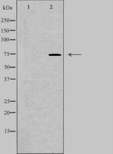SLC27A5 / BACS Antibody - Western blot analysis of extracts of HepG2 cells using SLC27A5 antibody. The lane on the left is treated with the antigen-specific peptide.