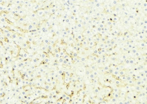 SLC27A5 / BACS Antibody - 1:100 staining mouse liver tissue by IHC-P. The sample was formaldehyde fixed and a heat mediated antigen retrieval step in citrate buffer was performed. The sample was then blocked and incubated with the antibody for 1.5 hours at 22°C. An HRP conjugated goat anti-rabbit antibody was used as the secondary.