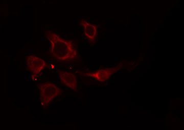SLC27A5 / BACS Antibody - Staining HepG2 cells by IF/ICC. The samples were fixed with PFA and permeabilized in 0.1% Triton X-100, then blocked in 10% serum for 45 min at 25°C. The primary antibody was diluted at 1:200 and incubated with the sample for 1 hour at 37°C. An Alexa Fluor 594 conjugated goat anti-rabbit IgG (H+L) antibody, diluted at 1/600, was used as secondary antibody.