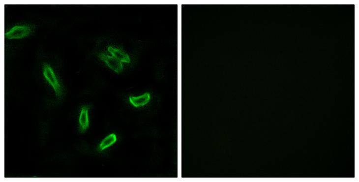 SLC27A5 / BACS Antibody - Peptide - + Immunofluorescence analysis of A549 cells, using SLC27A5 antibody.