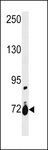 SLC28A1 Antibody - SLC28A1 Antibody western blot of ZR-75-1 cell line lysates (35 ug/lane). The SLC28A1 antibody detected the SLC28A1 protein (arrow).