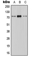 SLC28A1 Antibody - Western blot analysis of CNT1 expression in HEK293T (A); mouse brain (B); H9C2 (C) whole cell lysates.