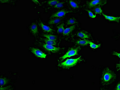 SLC28A1 Antibody - Immunofluorescent analysis of Hela cells using SLC28A1 Antibody at dilution of 1:100 and Alexa Fluor 488-congugated AffiniPure Goat Anti-Rabbit IgG(H+L)