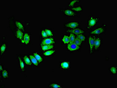 SLC28A1 Antibody - Immunofluorescent analysis of HepG2 cells using SLC28A1 Antibody at dilution of 1:100 and Alexa Fluor 488-congugated AffiniPure Goat Anti-Rabbit IgG(H+L)