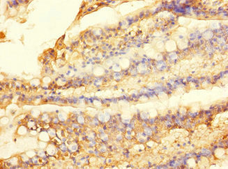 SLC28A1 Antibody - Immunohistochemistry of paraffin-embedded human small intestine tissue using SLC28A1 Antibody at dilution of 1:100