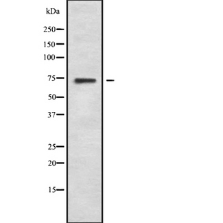 SLC28A1 Antibody - Western blot analysis SLC28A1 using Jurkat whole cells lysates