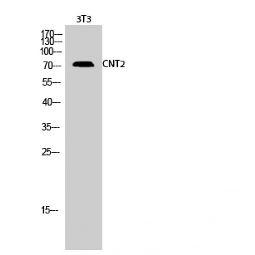 SLC28A2 Antibody - Western blot of CNT2 antibody