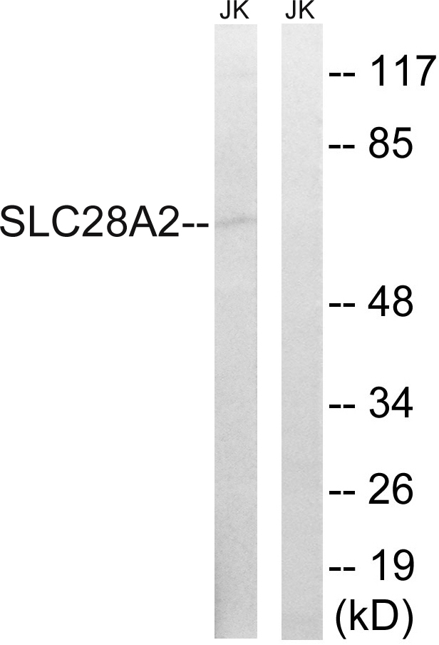 SLC28A2 Antibody - Western blot analysis of lysates from Jurkat cells, using SLC28A2 Antibody. The lane on the right is blocked with the synthesized peptide.