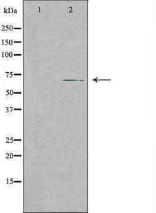 SLC28A2 Antibody - Western blot analysis of extracts of Jurkat cells using SLC28A2 antibody. The lane on the left is treated with the antigen-specific peptide.