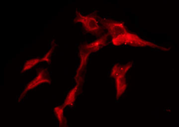 SLC28A2 Antibody - Staining HeLa cells by IF/ICC. The samples were fixed with PFA and permeabilized in 0.1% Triton X-100, then blocked in 10% serum for 45 min at 25°C. The primary antibody was diluted at 1:200 and incubated with the sample for 1 hour at 37°C. An Alexa Fluor 594 conjugated goat anti-rabbit IgG (H+L) Ab, diluted at 1/600, was used as the secondary antibody.
