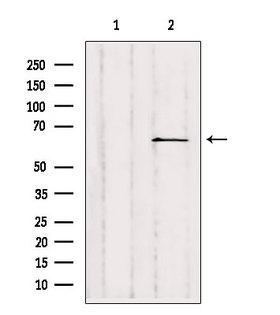 SLC28A2 Antibody - Western blot analysis of extracts of HepG2 cells using SLC28A2 antibody. Lane 1 was treated with the blocking peptide.