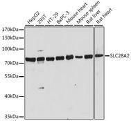 SLC28A2 Antibody - Western blot analysis of extracts of various cell lines using SLC28A2 Polyclonal Antibody at dilution of 1:1000.