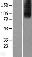 SLC28A2 Protein - Western validation with an anti-DDK antibody * L: Control HEK293 lysate R: Over-expression lysate