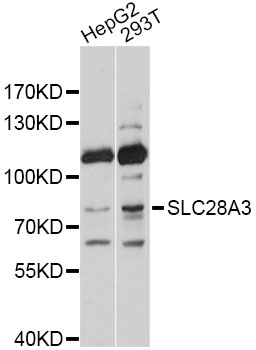 SLC28A3 Antibody - Western blot analysis of extracts of various cell lines, using SLC28A3 antibody at 1:1000 dilution. The secondary antibody used was an HRP Goat Anti-Rabbit IgG (H+L) at 1:10000 dilution. Lysates were loaded 25ug per lane and 3% nonfat dry milk in TBST was used for blocking. An ECL Kit was used for detection and the exposure time was 1s.