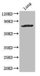 SLC28A3 Antibody - Positive WB detected in:Mouse heart tissue,Mouse liver tissue,Mouse lung tissue;All lanes: SLC28A3 antibody at 3ug/ml;Secondary;Goat polyclonal to rabbit IgG at 1/50000 dilution;Predicted band size: 77,70 kDa;Observed band size: 77 kDa;