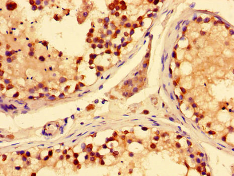 SLC28A3 Antibody - Immunohistochemistry of paraffin-embedded human testis tissue using SLC28A3 Antibody at dilution of 1:100