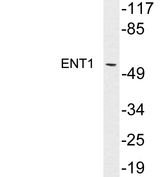 SLC29A1 / ENT1 Antibody - Western blot analysis of lysates from MDA-MB-435 cells, using ENT1 antibody.