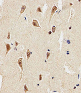 SLC29A1 / ENT1 Antibody - Immunohistochemical of paraffin-embedded H. brain section using ENT1(Slc29a1). Antibody was diluted at 1:25 dilution. A peroxidase-conjugated goat anti-rabbit IgG at 1:400 dilution was used as the secondary antibody, followed by DAB staining.