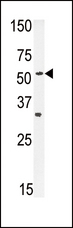 SLC29A1 / ENT1 Antibody - Western blot of ENT1 Antibody in mouse heart tissue lysates (35 ug/lane). ENT1 (arrow) was detected using the purified antibody.