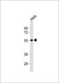 SLC29A1 / ENT1 Antibody - Anti-ENT1 Antibody at 1:1000 dilution + HeLa whole cell lysates Lysates/proteins at 20 ug per lane. Secondary Goat Anti-Rabbit IgG, (H+L),Peroxidase conjugated at 1/10000 dilution Predicted band size : 50 kDa Blocking/Dilution buffer: 5% NFDM/TBST.